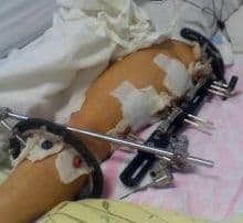 Foto: arhiva personală Emilia Iliescu