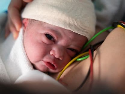 6 din 10 femei din România nasc prin cezariană, de patru ori mai mult față de recomandarea OMS. Operațiile, o practică în spitalele publice și la privat