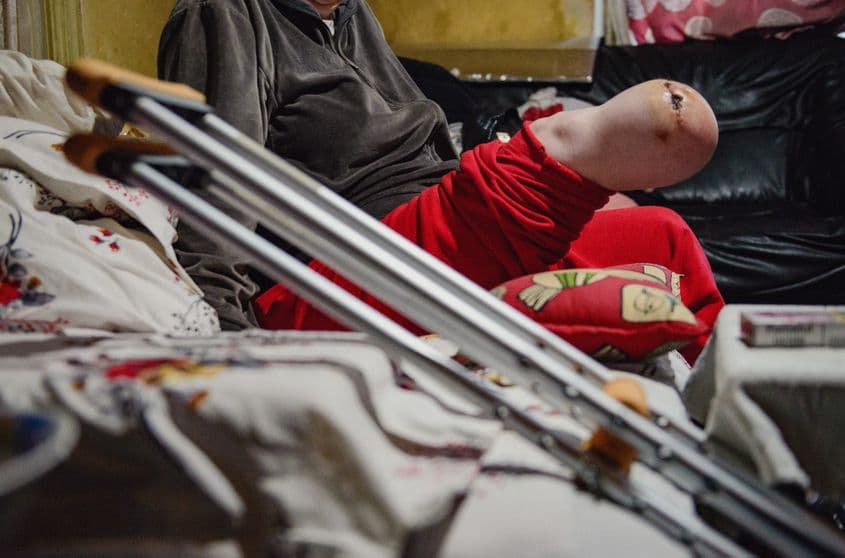 Doar unul din marginali: lucrătoare sexuală cu piciorul amputat recent, de câteva luni, de la diabet și artrită cronică. Foto: Ioana Epure