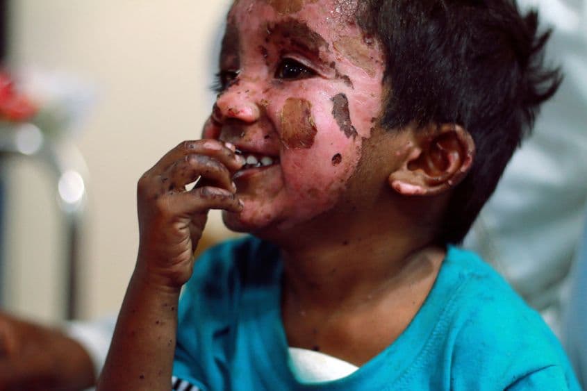 Un copil rănit în atentatul sinucigaș din Lahore. Foto: Maria-Cristiana Mărcuș